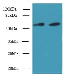 KBTBD4 Antibody