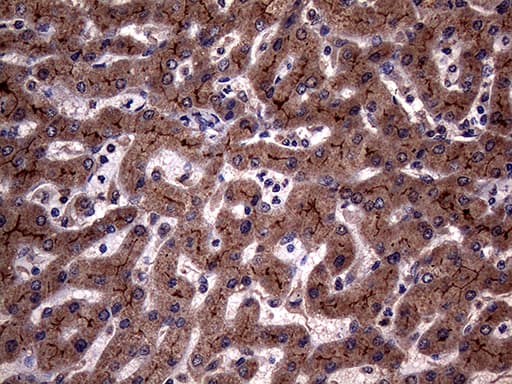 ABCB1 / MDR1 / P Glycoprotein Antibody (aa995-1280, clone OTI9C10, Carrier-free)