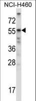 ACTRIIB / ACVR2B Antibody (aa148-176)