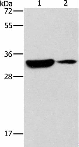 RCAN1 / DSCR1 Antibody