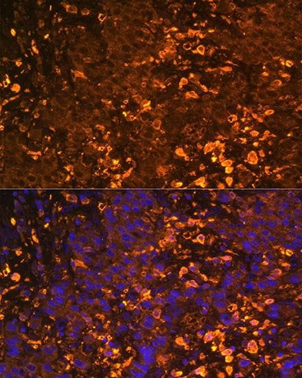 UGT1A / UGT1A1 Antibody
