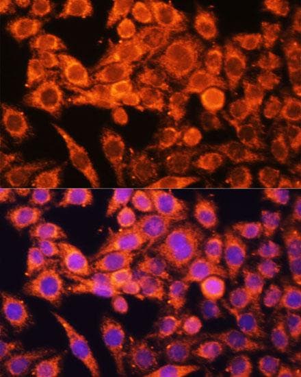 PRKAA1 / AMPK Alpha 1 Antibody