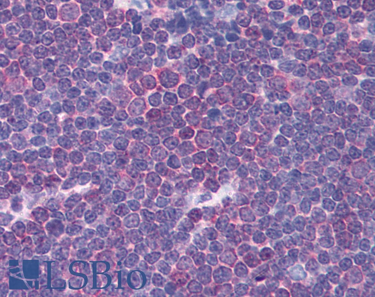 Polyclonal Rabbit anti-Human CHRNA3 Antibody (aa26-75, IHC, WB)