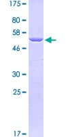 Human TLN1 / Talin 1 Protein (Recombinant GST, N-terminus)