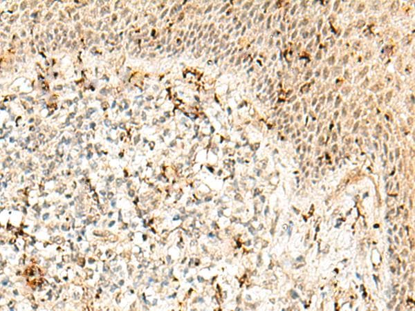 RBM15 Antibody
