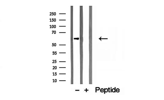 Polyclonal Rabbit anti-Human CKAP4 Antibody (IHC, IF, WB)