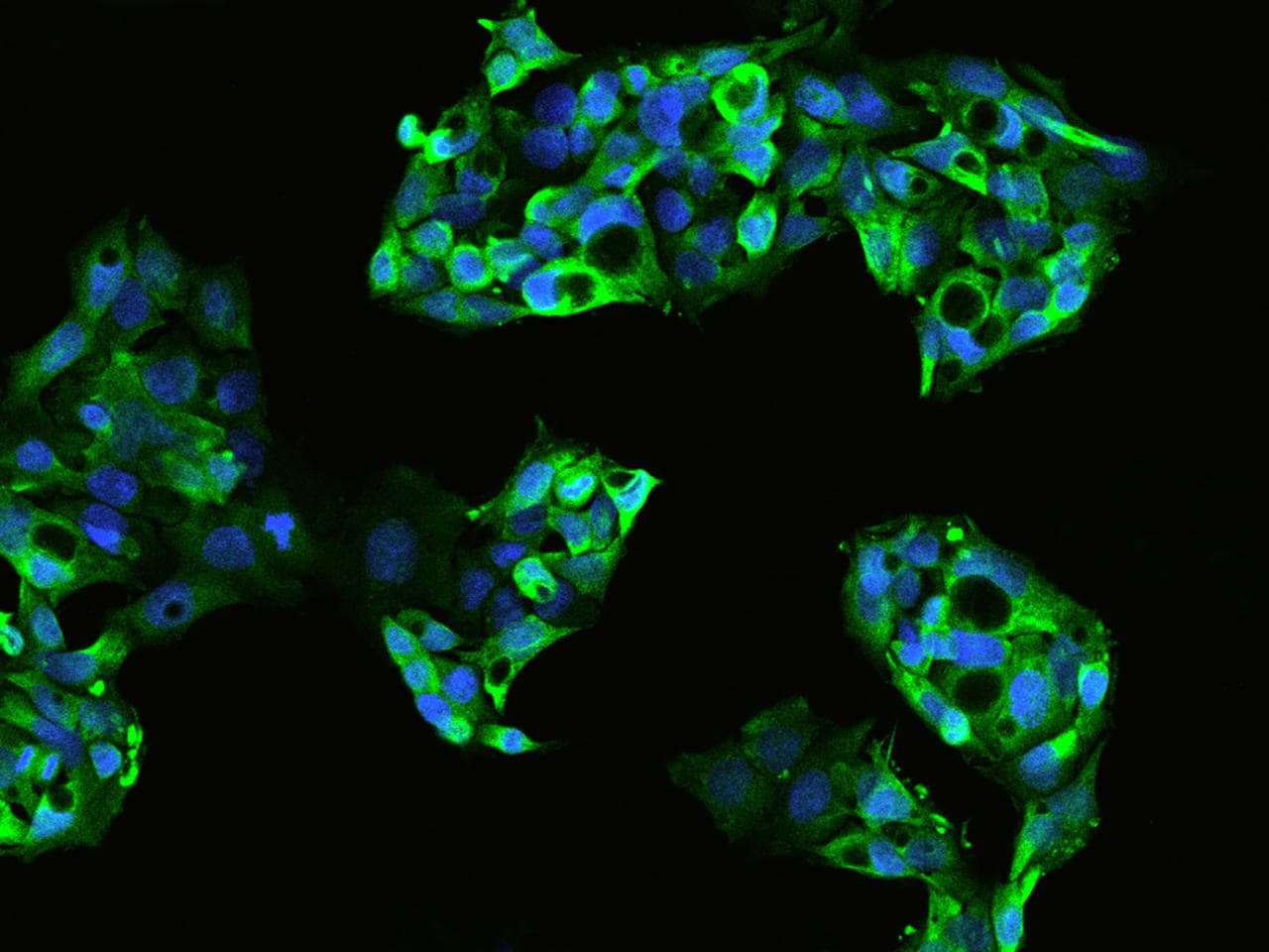 EDR / PEG10 Antibody
