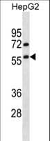 TRIM13 Antibody (aa61-90)