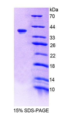 Human TNS1 / Tensin-1 Protein (Recombinant His-T7)