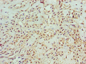 ASCC3 Antibody (aa1-111)