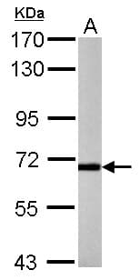 P2RX7 / P2X7 Antibody (C-Terminus)
