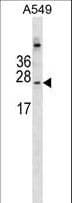 CALML6 Antibody (aa100-128)