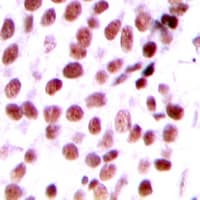DATF1 / DIDO1 Antibody (N-Terminus)