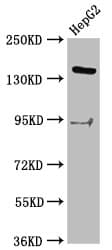 Polyclonal Rabbit anti-Human INO80 Antibody (IF, WB)
