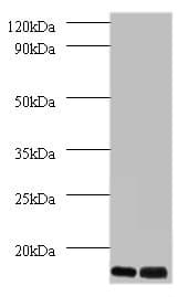 IHC-plus™ Polyclonal Rabbit anti-Human C14orf2 Antibody (IHC, WB)