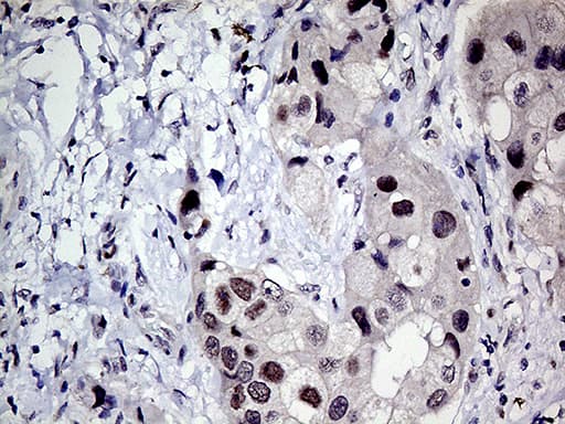 MLH1 Antibody (aa299-527, clone OTI4H6)