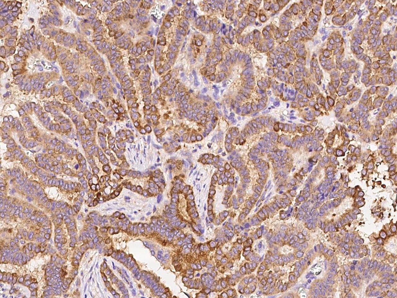 Polyclonal Rabbit anti-Human KRT24 / Keratin 24 Antibody (IHC)