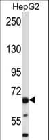 Polyclonal Rabbit anti-Human PHACTR2 Antibody (aa119-148, WB)