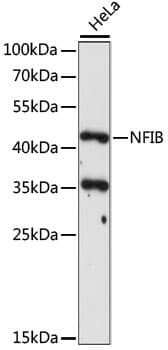 Polyclonal Rabbit anti-Human NFIB Antibody (WB)