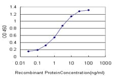 FOXO3 / FOXO3A Antibody (clone 1E11)