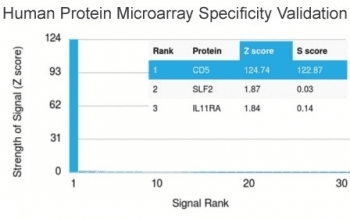 CD5 Antibody (clone CD5/2418)