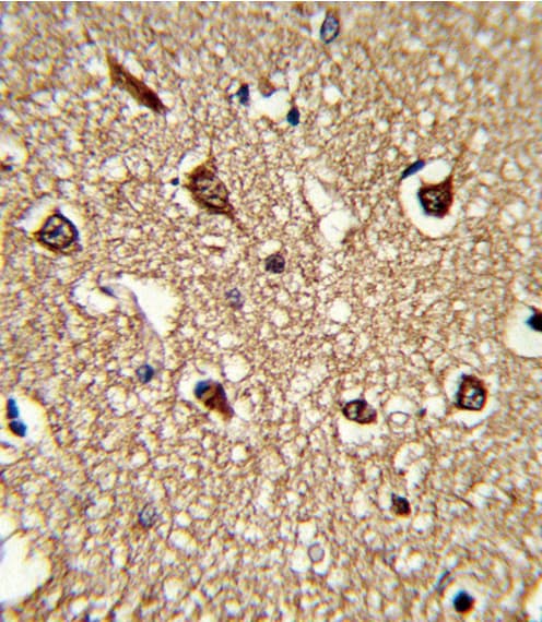 Polyclonal Rabbit anti-Human HLA-DRB1 Antibody (aa30-58, IHC, WB)