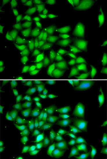 TREX1 Antibody