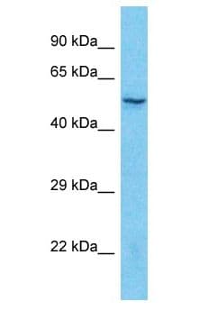 C14orf159 Antibody (aa472-521)