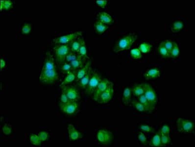 PathPlus™ S100A1 / S100-A1 Antibody (aa 2-94)