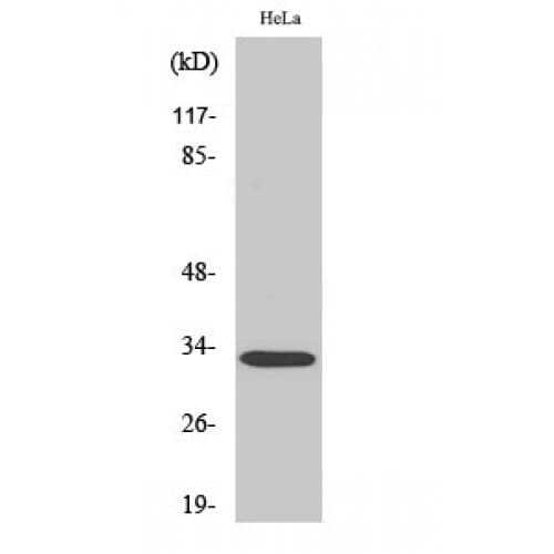 RRAD Antibody (10-90 aa, Internal)