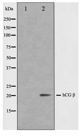 CGB / hCG Beta Antibody