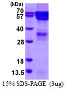 Human RGS14 Protein (Recombinant His)