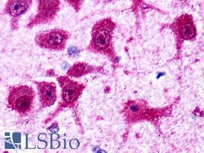 PathPlus™ GPR62 Antibody (C-Terminus)