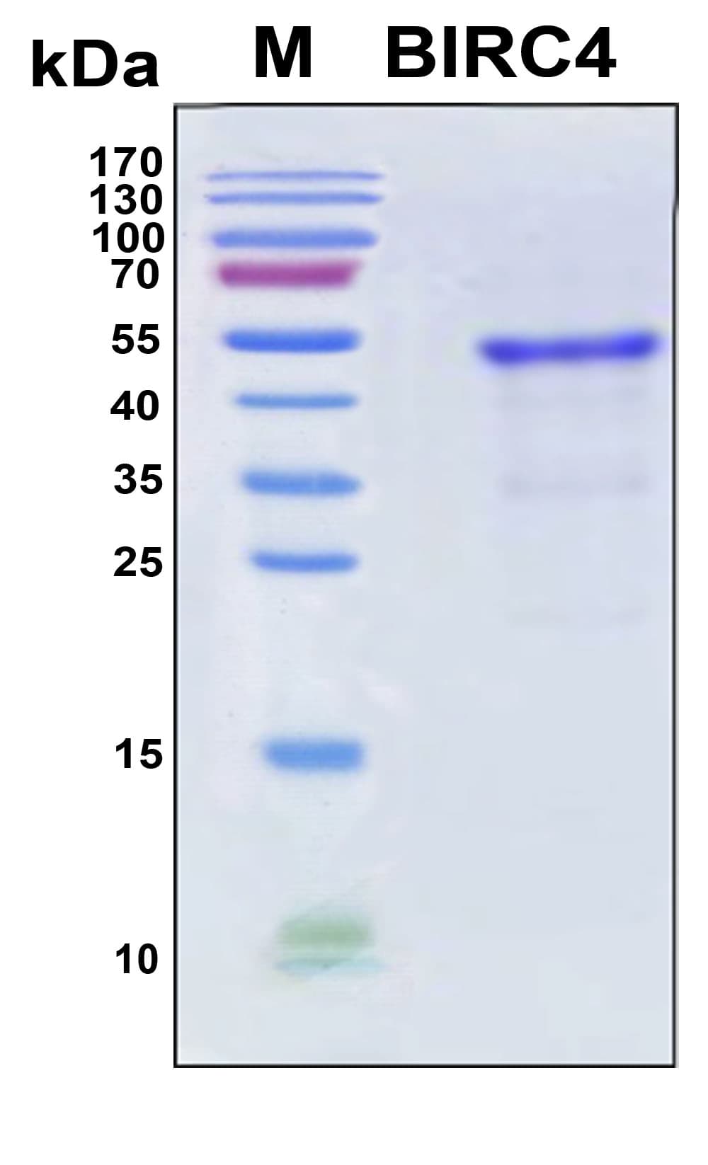 Human XIAP Protein (Recombinant 6His, N-terminus)