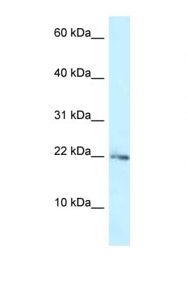 Polyclonal Rabbit anti-Human RPL23A Antibody (aa33-82, WB)