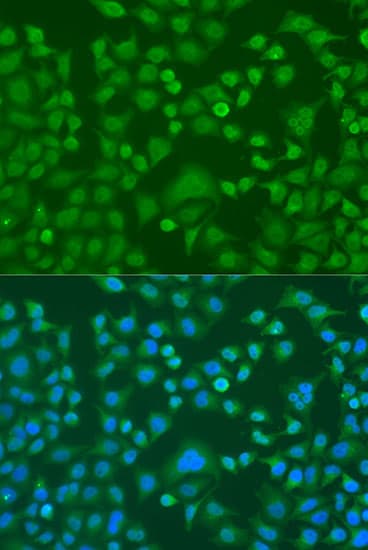 EWSR1 / EWS Antibody