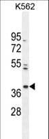 PURG Antibody (aa225-253)