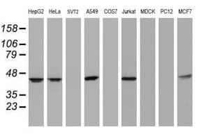 CBX8 Antibody (clone OTI3A11)