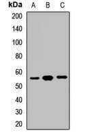 Polyclonal Rabbit anti-Human GPT / Alanine Transaminase Antibody (IHC, WB)