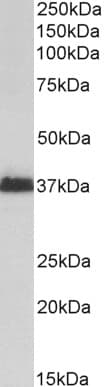 IHC-plus™ Polyclonal Goat anti-Human MSI2 Antibody (N Terminus, IHC, WB)