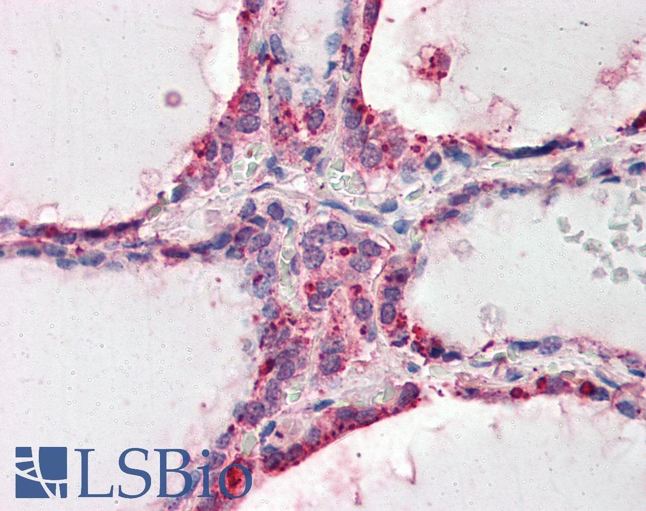 IHC-plus™ WNT3 Antibody (aa315-329)