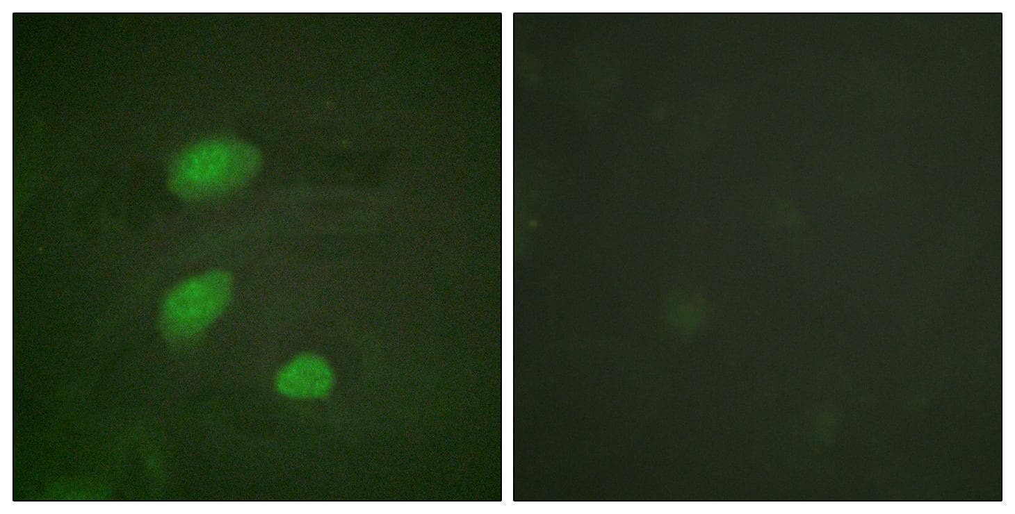 HIRA Antibody (phospho-Thr555)