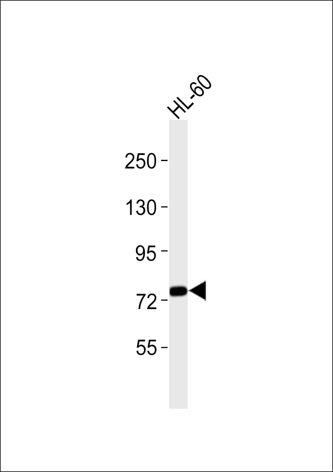ADCK3 / CABC1 Antibody