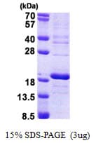 Human RPS16 / Ribosomal Protein S16 (Recombinant His)