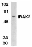IRAK2 / IRAK-2 Antibody