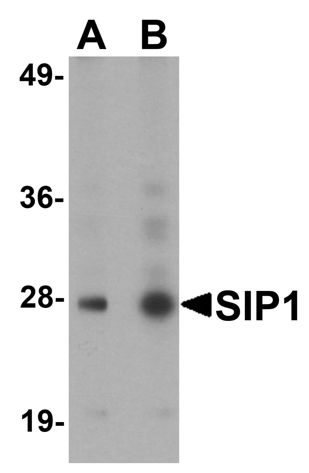 IHC-plus™ Polyclonal Rabbit anti-Human SIP1 Antibody (IHC, IF, WB)