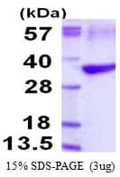 Human TPM3 Protein (Recombinant His)