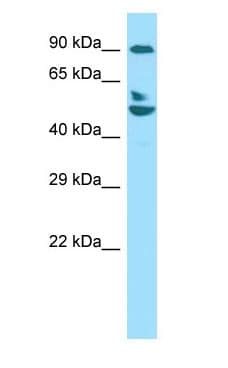 Polyclonal Rabbit anti-Human CAPRIN1 Antibody (C-Terminus, WB)