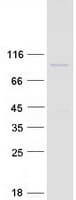 Human PHACTR2 Protein (Recombinant Myc-DDK (Flag))