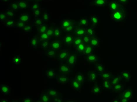 Polyclonal Rabbit anti-Human HIRIP3 Antibody (IHC, IF, WB)